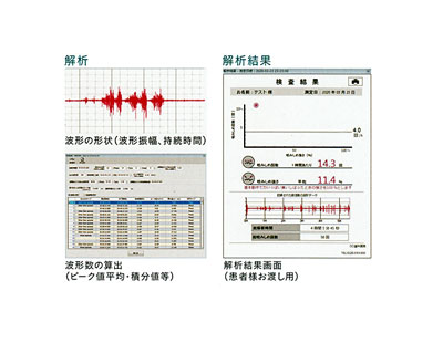 ウェアラブル筋電計