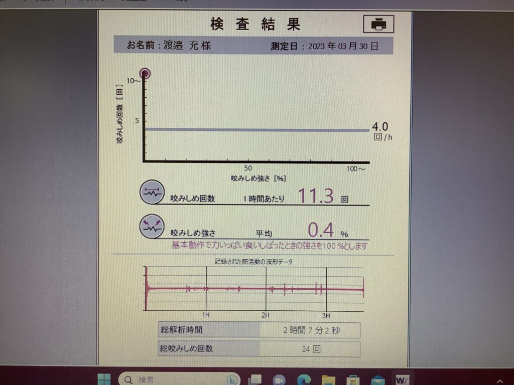 はぎしりを可視化する？？